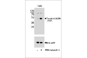 Western blot analysis of extracts from Hela cells, untreated or treated with calyculin A, using Phospho-Cdc25A Antibody . (CDC25A Antikörper  (pThr507))
