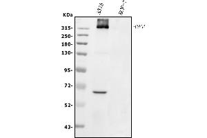 Western blot analysis of NG2/CSPG4 using anti-NG2/CSPG4 antibody (ABIN7602702).