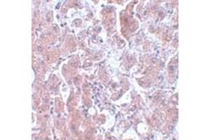 Immunohistochemistry (IHC) image for anti-ELOVL Fatty Acid Elongase 7 (ELOVL7) (N-Term) antibody (ABIN1031366) (ELOVL7 Antikörper  (N-Term))