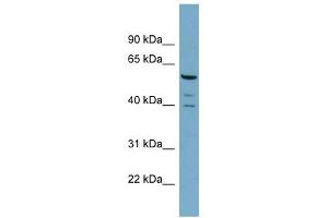 RABGEF1 antibody used at 1 ug/ml to detect target protein. (RABGEF1 Antikörper)
