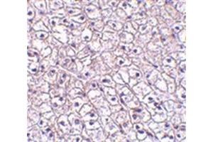 Image no. 1 for anti-Cytokine Receptor-Like Factor 2 (CRLF2) (Middle Region) antibody (ABIN318884) (CRLF2 Antikörper  (Middle Region))