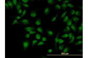 Image no. 2 for anti-CLK3 (CLK3) (AA 36-136) antibody (ABIN598614) (CLK3 Antikörper  (AA 36-136))