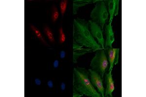 ABIN7094490 and ABIN7098539 staining  cells by IF/ICC. (Transportin 1 Antikörper  (C-Term))