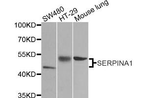 Western blot analysis of extracts of various cell lines, using SERPINA1 antibody (ABIN5970396) at 1/1000 dilution. (SERPINA1 Antikörper)