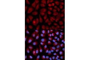 Immunofluorescence (IF) image for anti-Vimentin (VIM) (AA 1-200) antibody (ABIN3016292) (Vimentin Antikörper  (AA 1-200))