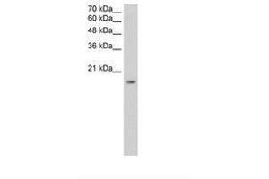 Image no. 2 for anti-Zinc Finger Protein 580 (ZNF580) (AA 31-80) antibody (ABIN6736331) (ZNF580 Antikörper  (AA 31-80))