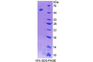 SDS-PAGE (SDS) image for Serpin Family C Member 1 (SERPINC1) (AA 33-465) protein (His tag) (ABIN6239080) (SERPINC1 Protein (AA 33-465) (His tag))