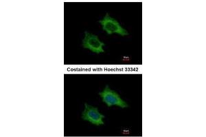 ICC/IF Image Immunofluorescence analysis of methanol-fixed HeLa, using PRPSAP2, antibody at 1:500 dilution. (PRPSAP2 Antikörper)