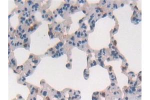 Immunohistochemistry (IHC) image for anti-Cytoglobin (CYGB) (AA 1-190) antibody (ABIN7434902)