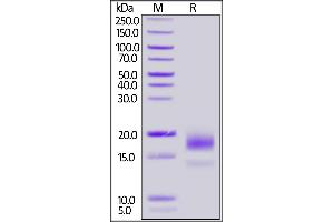 Biotinylated Human CD59, His,Avitag on  under reducing (R) condition.