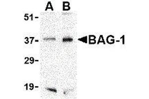 Western Blotting (WB) image for anti-BCL2-Associated Athanogene (BAG1) (C-Term) antibody (ABIN2477576) (BAG1 Antikörper  (C-Term))