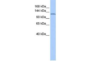 WB Suggested Anti-NUP155 Antibody Titration: 0. (NUP155 Antikörper  (N-Term))