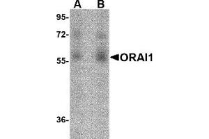 Western Blotting (WB) image for anti-ORAI Calcium Release-Activated Calcium Modulator 1 (ORAI1) (C-Term) antibody (ABIN492545) (ORAI1 Antikörper  (C-Term))