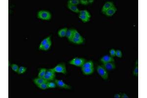 Immunofluorescent analysis of HepG2 cells using ABIN7172795 at dilution of 1:100 and Alexa Fluor 488-congugated AffiniPure Goat Anti-Rabbit IgG(H+L) (Transferrin Receptor Antikörper  (AA 94-754))