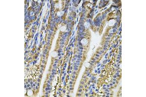 Immunohistochemistry of paraffin-embedded mouse intestine using NFU1 Antibody (ABIN2564134) at dilution of 1:100 (40x lens). (NFU1 Antikörper)