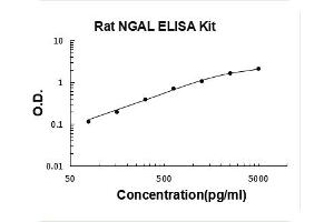 Rat Lipocalin-2/NGAL PicoKine ELISA Kit standard curve|Rat Lipocalin-2/NGAL PicoKine ELISA Kit standard curve|Rat Lipocalin-2/NGAL PicoKine ELISA Kit standard curve|Rat Lipocalin-2/NGAL PicoKine ELISA Kit standard curve|Rat Lipocalin-2/NGAL PicoKine ELISA Kit standard curve|Rat Lipocalin-2/NGAL PicoKine ELISA Kit standard curve|Rat Lipocalin-2/NGAL PicoKine ELISA Kit standard curve