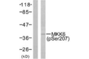 Image no. 1 for anti-Mitogen-Activated Protein Kinase Kinase 6 (MAP2K6) (pSer207) antibody (ABIN318071) (MAP2K6 Antikörper  (pSer207))