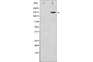 Western Blotting (WB) image for anti-phospholipase C, gamma 1 (PLCG1) (pTyr771) antibody (ABIN6256799)