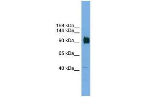 WB Suggested Anti-Zfp445 Antibody Titration:  0. (ZNF445 Antikörper  (Middle Region))