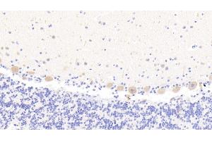 Detection of MAN1A1 in Human Cerebellum Tissue using Polyclonal Antibody to Mannosidase Alpha Class 1A Member 1 (MAN1A1) (MAN1A1 Antikörper  (AA 322-653))