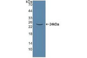 Detection of Recombinant PANX1, Human using Polyclonal Antibody to Pannexin 1 (PANX1) (PANX1 Antikörper  (AA 228-411))