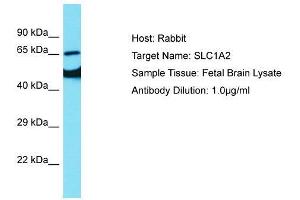 Host:  Rabbit  Target Name:  SLC1A2  Sample Type:  Fetal Brain lysates  Antibody Dilution:  1. (SLC1A2 Antikörper  (N-Term))