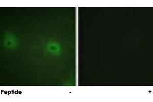 Immunofluorescence analysis of HUVEC cells, using STAM2 polyclonal antibody .