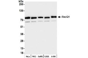 Western Blotting (WB) image for anti-RecQ Protein-Like (DNA Helicase Q1-Like) (RECQL) (AA 1-50) antibody (ABIN7453821) (RecQ Protein-Like (DNA Helicase Q1-Like) (RECQL) (AA 1-50) Antikörper)