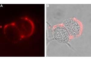 Immunocytochemistry (ICC) image for anti-gamma-aminobutyric Acid (GABA) A Receptor, alpha 6 (GABRA6) (AA 20-37), (Extracellular) antibody (ABIN7043190)