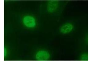 Immunofluorescence (IF) image for anti-Heterogeneous Nuclear Ribonucleoprotein A2/B1 (HNRNPA2B1) antibody (ABIN1449240) (HNRNPA2B1 Antikörper)