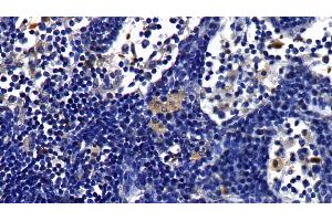 Immunohistochemistry (IHC) image for anti-Interleukin 1 Receptor, Type I (IL1R1) (AA 21-109) antibody (ABIN7430735)