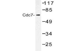 Western blot (WB) analysis of Cdc7 antibody in extracts from Jurkat cells. (CDC7 Antikörper)