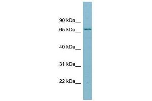 SLC27A5 antibody used at 1 ug/ml to detect target protein. (SLC27A5 Antikörper)