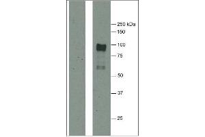 Western Blotting (WB) image for anti-Fibrinogen (citrullinated) antibody (ABIN1107223) (Fibrinogen Antikörper  (citrullinated))