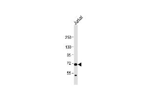 Anti-HAUS5 Antibody (N-term) at 1:1000 dilution + Jurkat whole cell lysate Lysates/proteins at 20 μg per lane. (HAUS5 Antikörper  (N-Term))