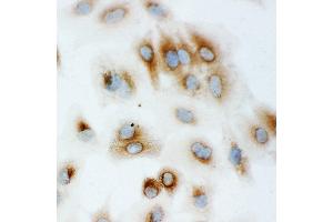 Anti-Hsp70 antibody, ICC ICC: A549 Cell (HSP70 1A Antikörper  (C-Term))