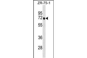 Western blot analysis in ZR-75-1 cell line lysates (35ug/lane). (ZNF654 Antikörper  (C-Term))