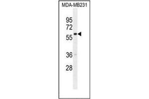 Western blot analysis of GNL3L Antibody (N-term) in MDA-MB231 cell line lysates (35ug/lane). (GNL3L Antikörper  (N-Term))