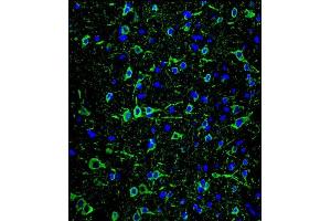 Confocal immunofluorescent analysis of P2 Antibody ABIN659033 with brain tissue followed by Alexa Fluor® 488-conjugated goat anti-mouse lgG (green).