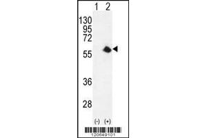 Western blot analysis of CDK8 using rabbit polyclonal CDK8 Antibody using 293 cell lysates (2 ug/lane) either nontransfected (Lane 1) or transiently transfected (Lane 2) with the CDK8 gene. (CDK8 Antikörper  (AA 249-277))