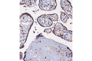 Immunohistochemistry of paraffin-embedded Human placenta using WDR61 Rabbit pAb (ABIN7271361) at dilution of 1:100 (40x lens). (WDR61 Antikörper  (AA 1-305))