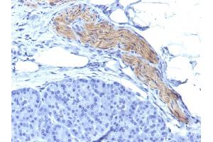 Formalin-fixed, paraffin-embedded human Pancreas stained with CD56 Mouse Monoclonal Antibody (NCAM1/795). (CD56 Antikörper)