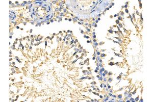 ABIN6258875 and ABIN6274225 at 1/100 staining Rat testis tissue by IHC-P.