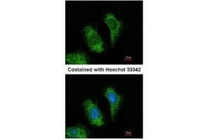 ICC/IF Image Immunofluorescence analysis of methanol-fixed HeLa, using TRAF5, antibody at 1:200 dilution. (TRAF5 Antikörper  (N-Term))
