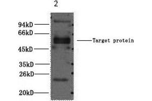 Western Blotting (WB) image for anti-Fc Fragment of IgE, Low Affinity II, Receptor For (CD23) (FCER2) antibody (ABIN5960827) (FCER2 Antikörper)
