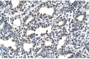 Immunohistochemical staining (Formalin-fixed paraffin-embedded sections) of human lung with KCTD6 polyclonal antibody .