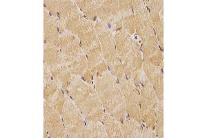 (ABIN6244021 and ABIN6578763) staining TK1 in human skeletal muscle tissue sections by Immunohistochemistry (IHC-P - paraformaldehyde-fixed, paraffin-embedded sections). (TK1 Antikörper  (AA 139-173))