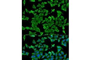 Immunofluorescence analysis of U2OS cells using ACTR2 Polyclonal Antibody (ACTR2 Antikörper)