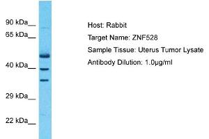 Host: Rabbit Target Name: ZNF528 Sample Type: Uterus Tumor lysates Antibody Dilution: 1.