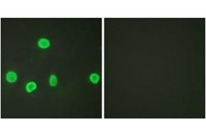 Immunofluorescence (IF) image for anti-Histone H3 (H3) (H3K18ac) antibody (ABIN2879163) (Histone 3 Antikörper  (H3K18ac))